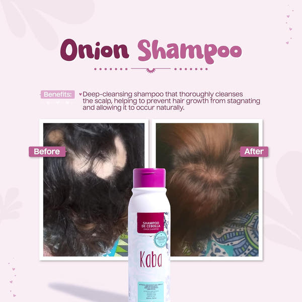 Kaba Onion Shampoo de Cebolla for Hair Growth, Sulfate-Free, Paraben-Free, Stimulates Hair Regrowth, Reduces Hair Loss, Deep Scalp Cleanse, All Hair Types - 500 ML