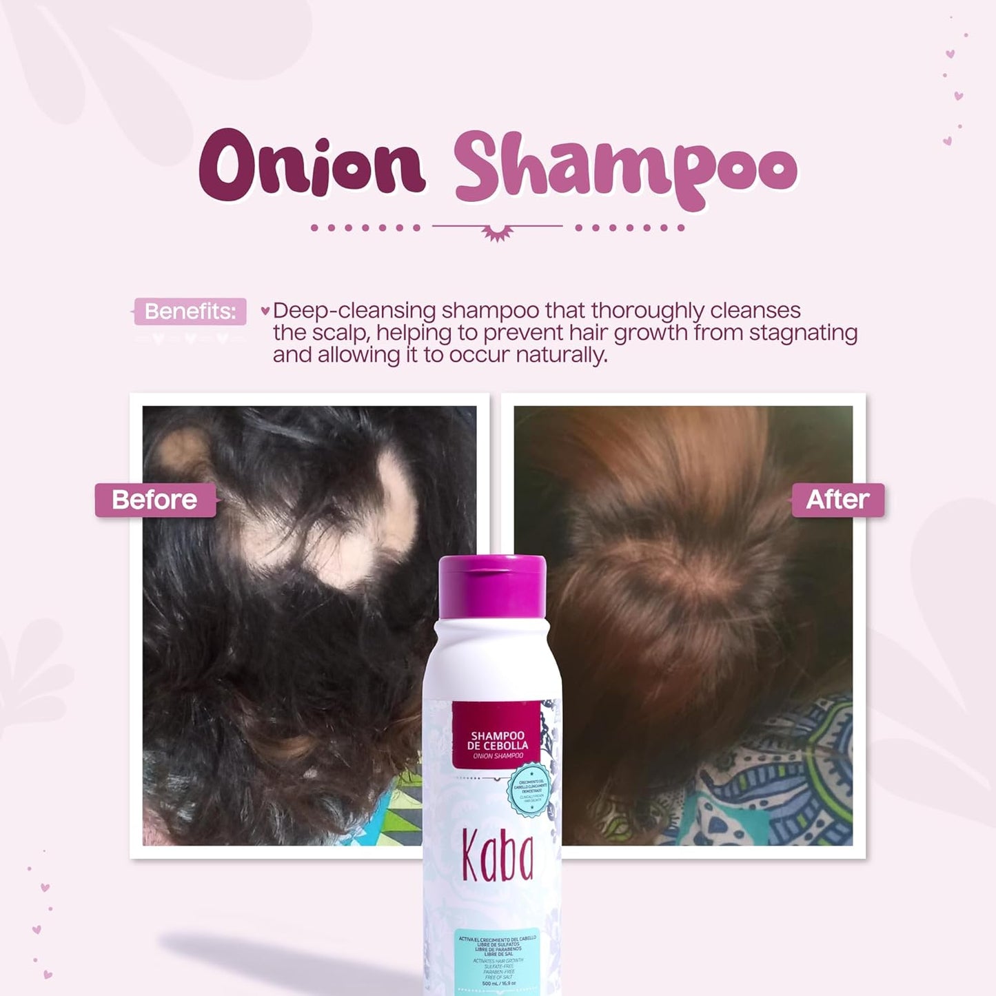 Kaba Onion Shampoo de Cebolla for Hair Growth, Sulfate-Free, Paraben-Free, Stimulates Hair Regrowth, Reduces Hair Loss, Deep Scalp Cleanse, All Hair Types - 500 ML