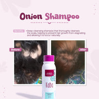 Kaba Onion Shampoo de Cebolla for Hair Growth, Sulfate-Free, Paraben-Free, Stimulates Hair Regrowth, Reduces Hair Loss, Deep Scalp Cleanse, All Hair Types - 500 ML